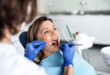 Veneers Unveiled: The Science of Seamless Smile Integration