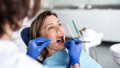Veneers Unveiled: The Science of Seamless Smile Integration
