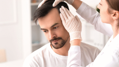 Is Restoring Your Hairline in Dubai the Best Choice for Your Transformation?